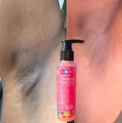 ClearTan  Dead Skin & Tan Remover for Smooth, Radiant Skin  (Buy 1 Get 1 Free)